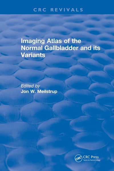 Produktbild: Imaging Atlas of the Normal Gallbladder and Its Variants