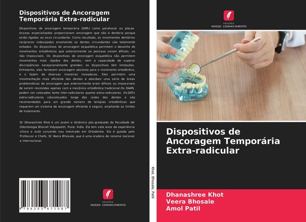 Produktbild: Dispositivos de Ancoragem Tempor&aacute;ria Extra-radicular
