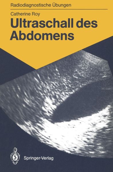 Ultraschall des Abdomens, Taschenbuch von Catherine Roy, Springer Berlin, 9783540165484