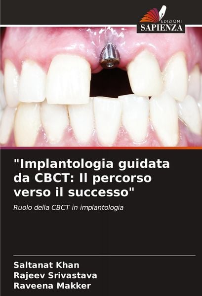 Produktbild: "Implantologia guidata da CBCT: Il percorso verso il successo"