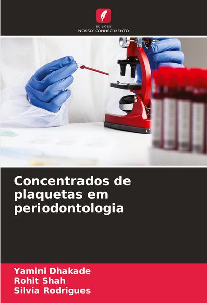 Produktbild: Concentrados de plaquetas em periodontologia