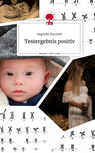 Produktbild: Testergebnis positiv. Life is a Story - story.one