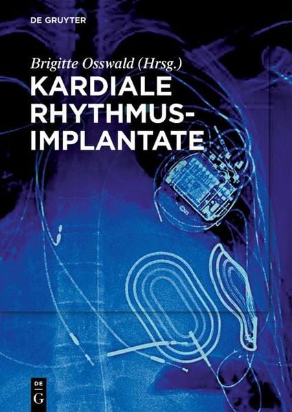 Produktbild: Kardiale Rhythmusimplantate