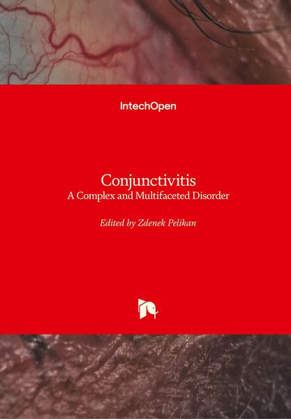 Produktbild: Conjunctivitis