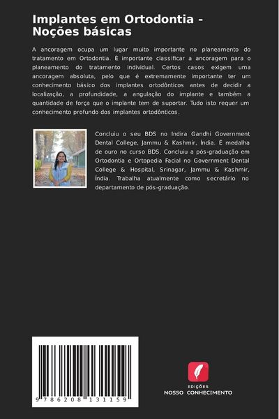Produktbild: Implantes em Ortodontia - No&ccedil;&otilde;es b&aacute;sicas