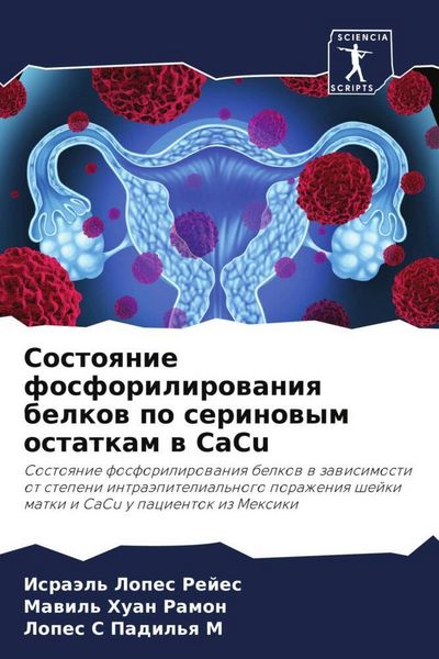 Produktbild: Sostoqnie fosforilirowaniq belkow po serinowym ostatkam w CaCu