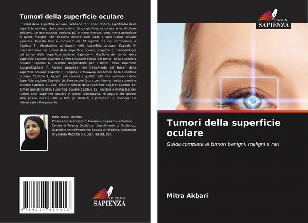 Produktbild: Tumori della superficie oculare