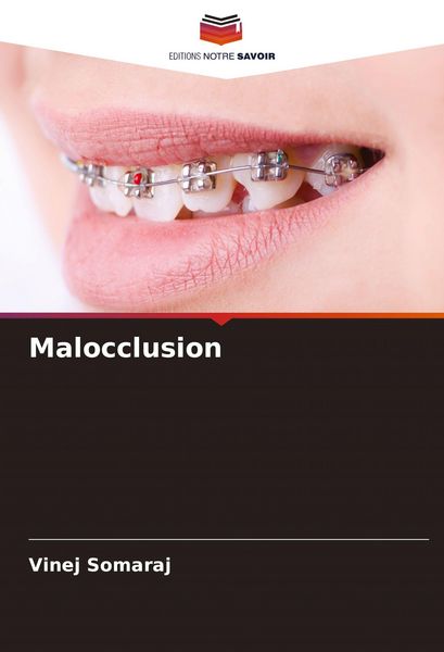 Produktbild: Malocclusion