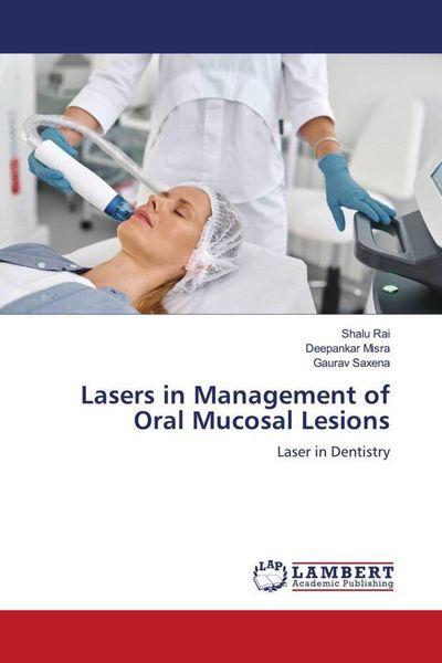 Produktbild: Lasers in Management of Oral Mucosal Lesions