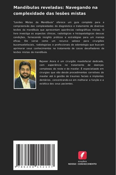 Produktbild: Mand&iacute;bulas reveladas: Navegando na complexidade das les&otilde;es mistas