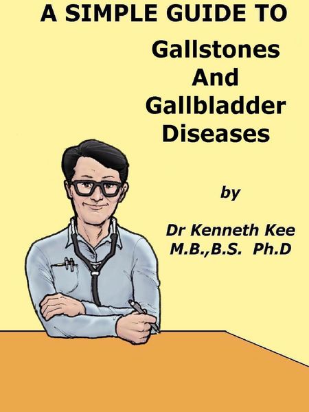 Produktbild: A Simple Guide to Gallstones and Gallbldder Diseasess (A Simple Guide to Medical Conditions, #34)