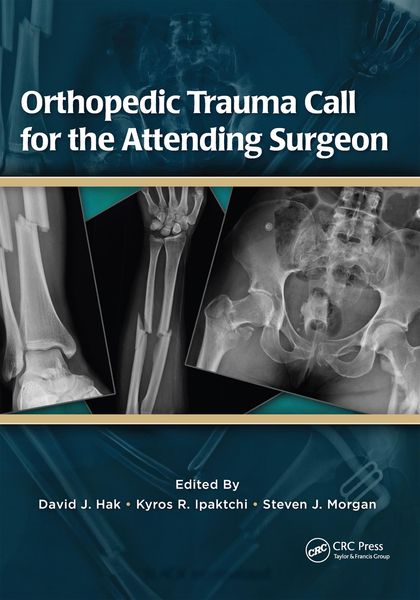 Produktbild: Orthopedic Trauma Call for the Attending Surgeon