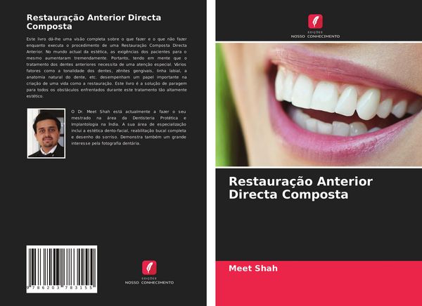Produktbild: Restaura&ccedil;&atilde;o Anterior Directa Composta