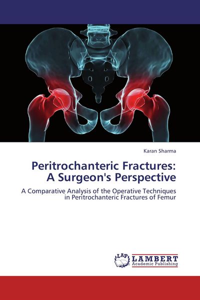 Produktbild: Peritrochanteric Fractures: A Surgeon's Perspective