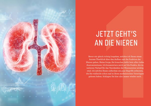 Produktbild: Nierensteine – Ursachen erkennen, richtig behandeln, Rückfälle verhindern