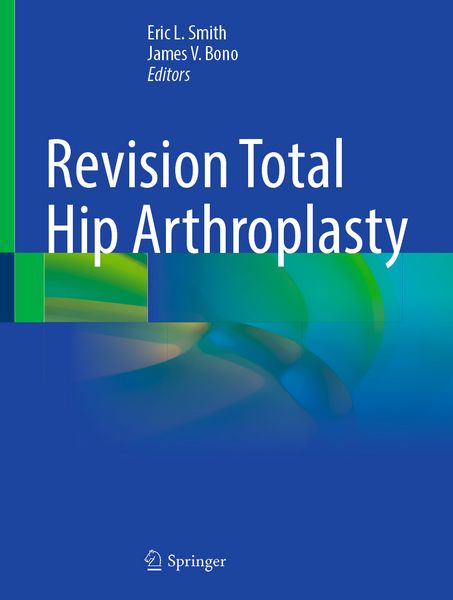 Produktbild: Revision Total Hip Arthroplasty