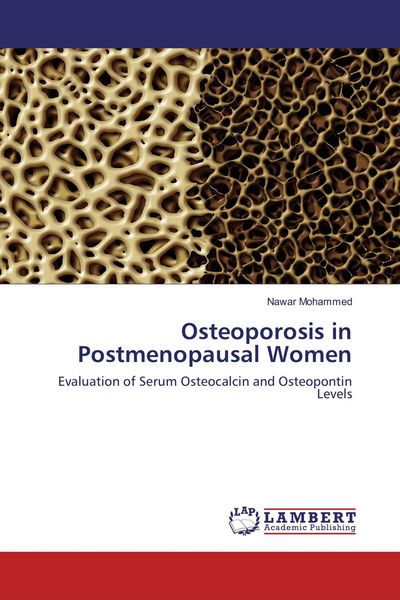 Produktbild: Osteoporosis in Postmenopausal Women