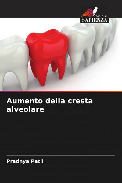 Produktbild: Aumento della cresta alveolare
