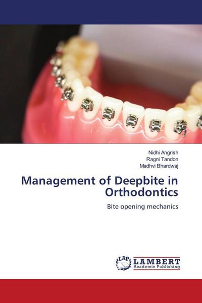 Produktbild: Management of Deepbite in Orthodontics