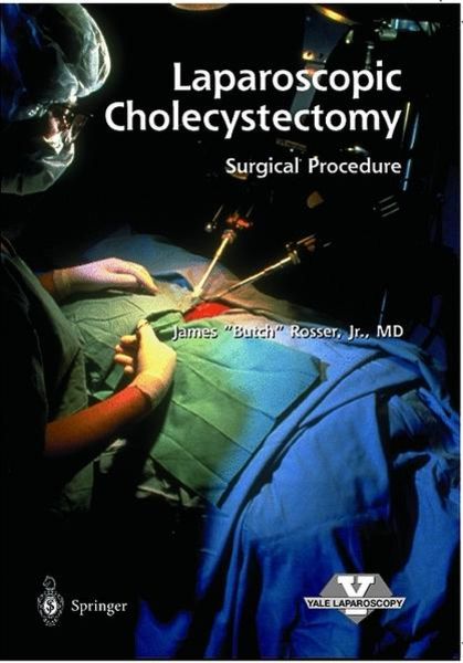 Laparoscopic Cholecystectomy - Surgical Procedure