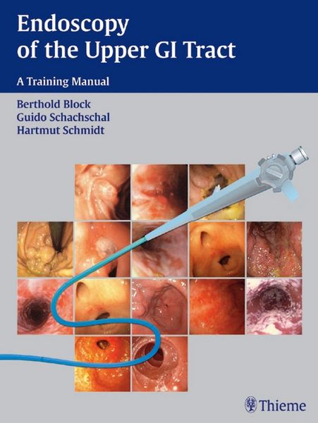 Produktbild: Endoscopy of the Upper GI Tract