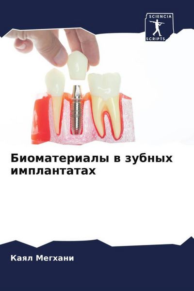 Produktbild: Biomaterialy w zubnyh implantatah