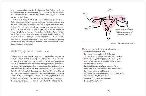 Produktbild: Leben mit Endometriose