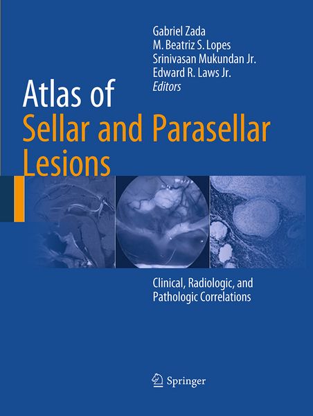 Produktbild: Atlas of Sellar and Parasellar Lesions