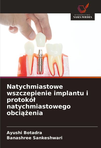 Produktbild: Natychmiastowe wszczepienie implantu i protok&oacute;&iquest; natychmiastowego obci&iquest;&iquest;enia