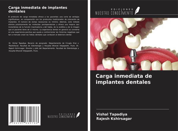 Produktbild: Carga inmediata de implantes dentales
