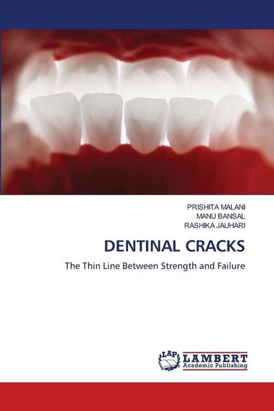 Produktbild: Dentinal Cracks