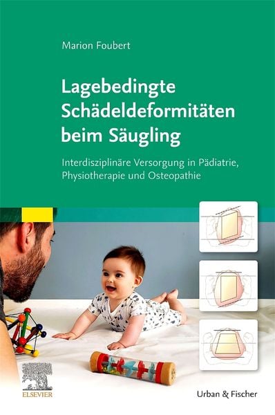 Produktbild: Lagebedingte Sch&auml;deldeformit&auml;ten beim S&auml;ugling