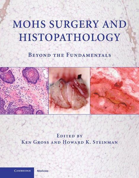 Produktbild: Mohs Surgery and Histopathology