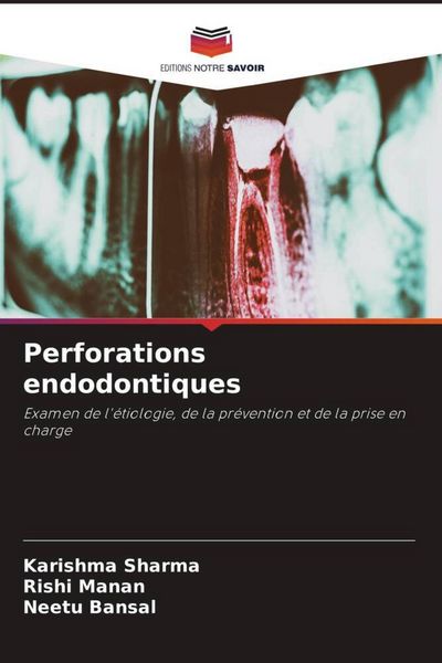 Produktbild: Perforations endodontiques