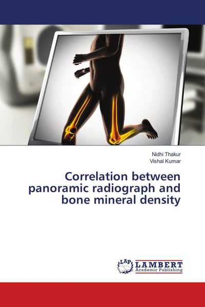 Produktbild: Correlation between panoramic radiograph and bone mineral density