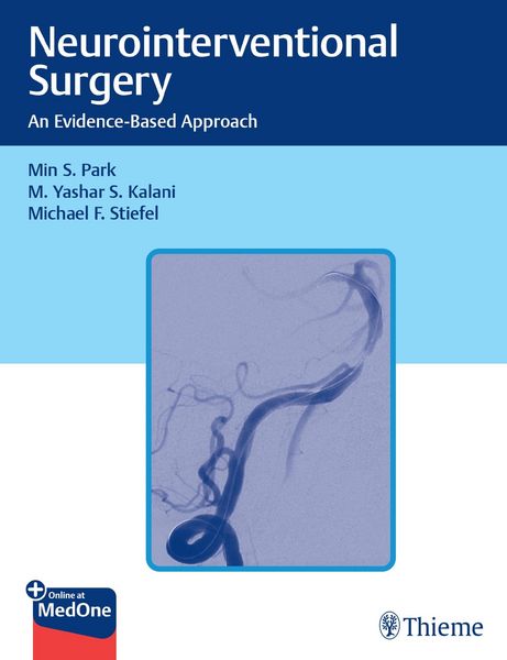 Produktbild: Neurointerventional Surgery