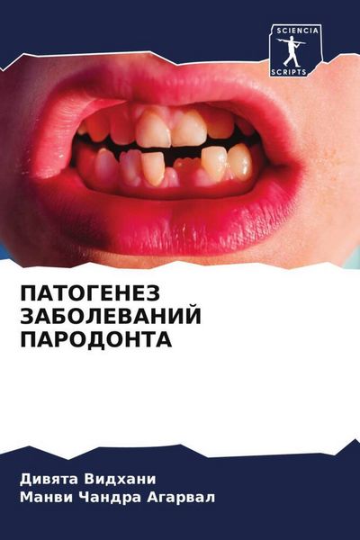 Produktbild: Patogenez Zabolevanij Parodonta