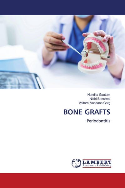 Produktbild: BONE GRAFTS