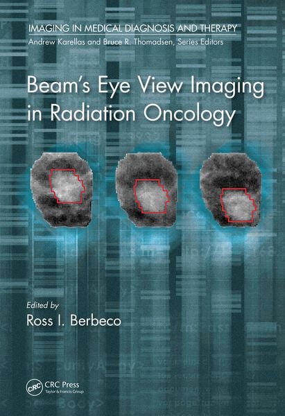 Produktbild: Beam's Eye View Imaging in Radiation Oncology