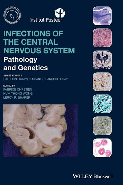 Produktbild: Infections of the Central Nervous System