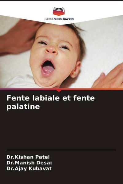 Produktbild: Fente labiale et fente palatine