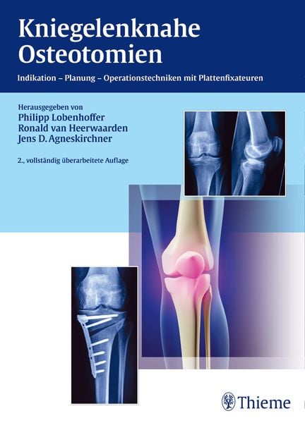 Produktbild: Kniegelenknahe Osteotomien