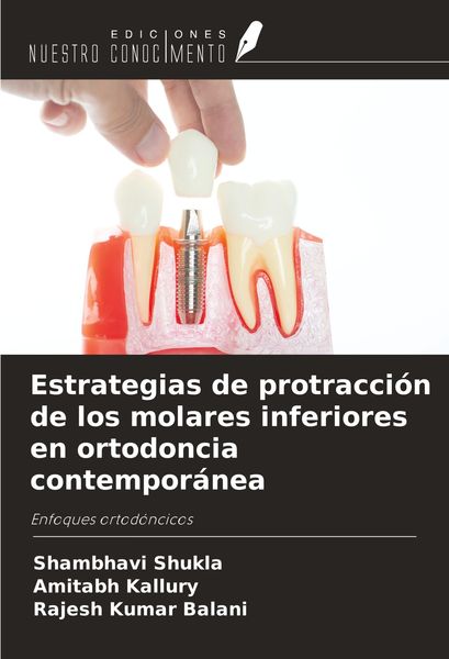 Produktbild: Estrategias de protracci&oacute;n de los molares inferiores en ortodoncia contempor&aacute;nea