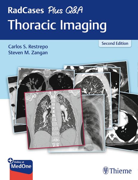 Produktbild: RadCases Plus Q&A Thoracic Imaging