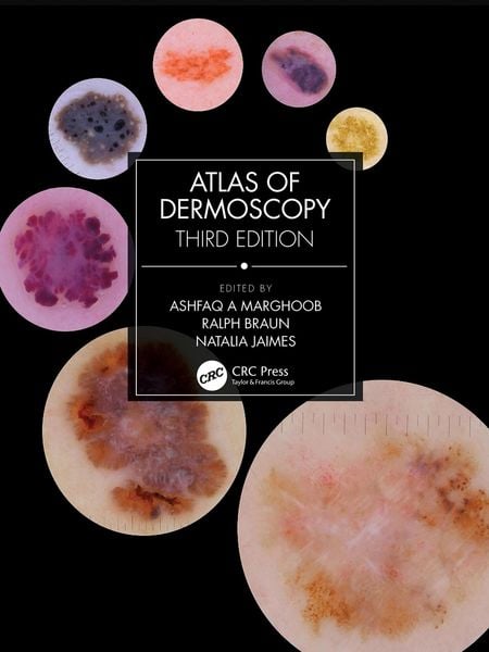 Produktbild: Atlas of Dermoscopy