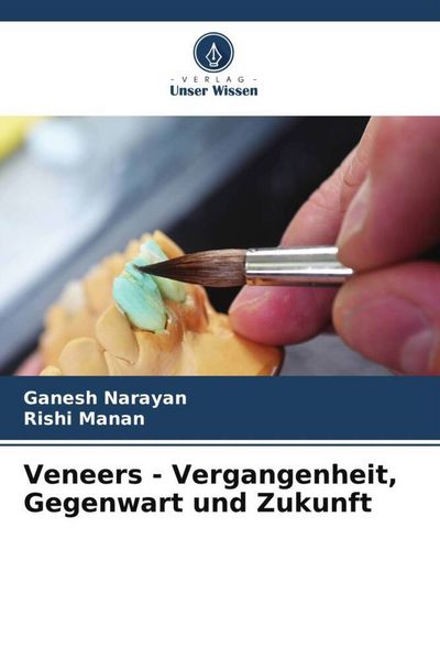 Produktbild: Veneers - Vergangenheit, Gegenwart und Zukunft