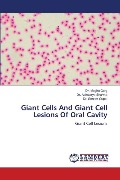 Produktbild: Giant Cells And Giant Cell Lesions Of Oral Cavity