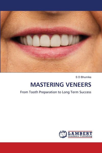 Produktbild: Mastering Veneers
