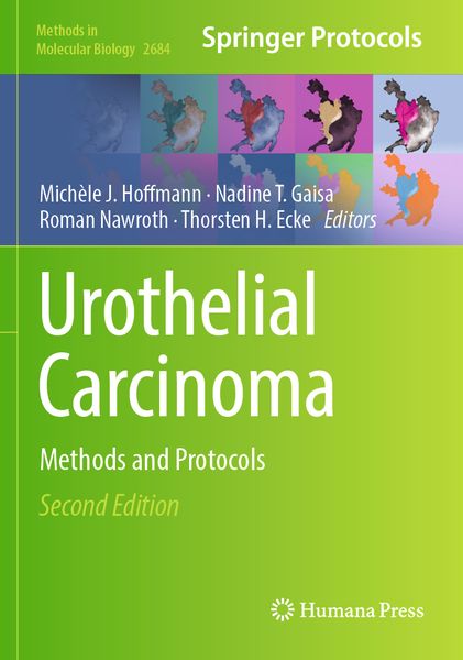 Produktbild: Urothelial Carcinoma