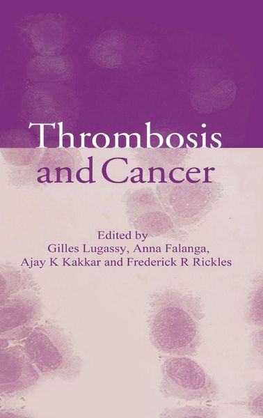 Produktbild: Thrombosis and Cancer